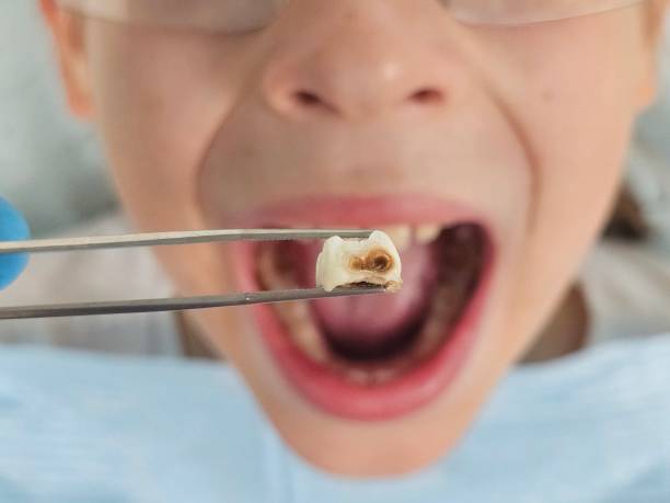 Best Emergency Pediatric Dental Care in Holcom, KS